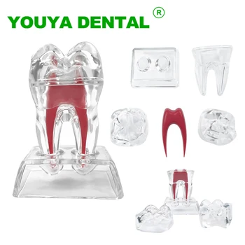 Анатомическая модель зубов Прозрачная Модель Моляра Съемная Демонстрационная Модель Разложения структуры Одного Зуба Кристаллическая Основа